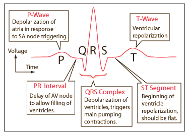 QRS complex